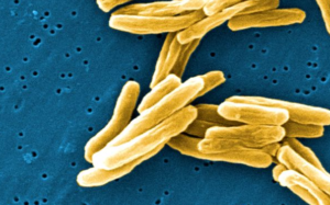 Tuberculosis bacteria chopin