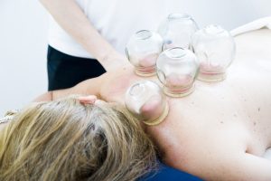 Most find the cupping therapy pleasurable and relaxing.